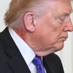 Amerika Serikat: Luncurkan Serangan Presisi ke Iran, Gedung Putih Hadapi Spekulasi Kesehatan Presiden